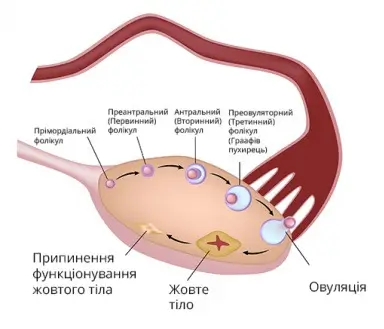 what-is-pcos-1-ua